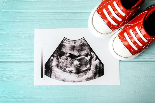 Foto de ultra-som e botas de bebê em fundo de madeira azul