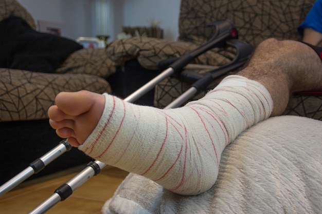 Foto horizontal de um homem adulto com a perna engessada e enfaixada em um banquinho com muletas ao lado dele. Conceito de reabilitação de pessoas após lesões graves por acidente físico.