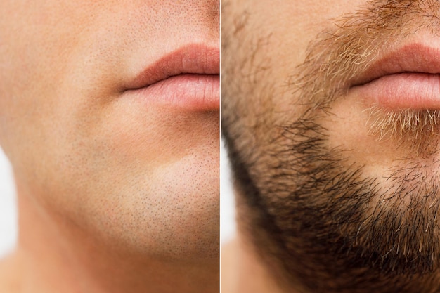 Una foto en primer plano de la cara de un hombre sin barba y con barba