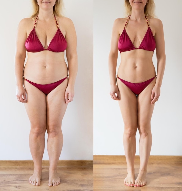 Foto real de mujer antes y después de bajar de peso.