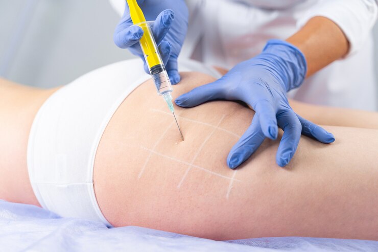 Foto foto recortada de un dermatólogo que minimiza la apariencia de celulitis en las nalgas de la joven.