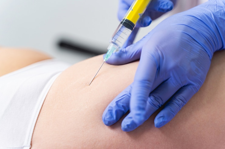 Foto foto recortada de una doctora dando una inyección para las estrías a un paciente
