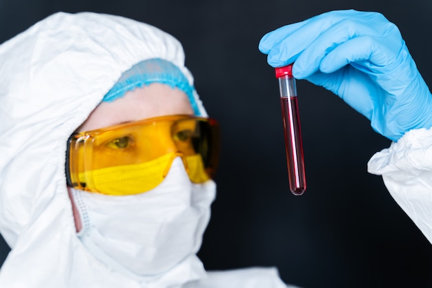 Fotografia conceitual - testes laboratoriais em amostras de sangue de pacientes para presença de coronavírus (covid-19)