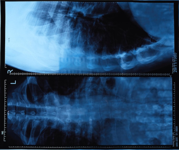 Fotografia de raios-X dos ossos das costas