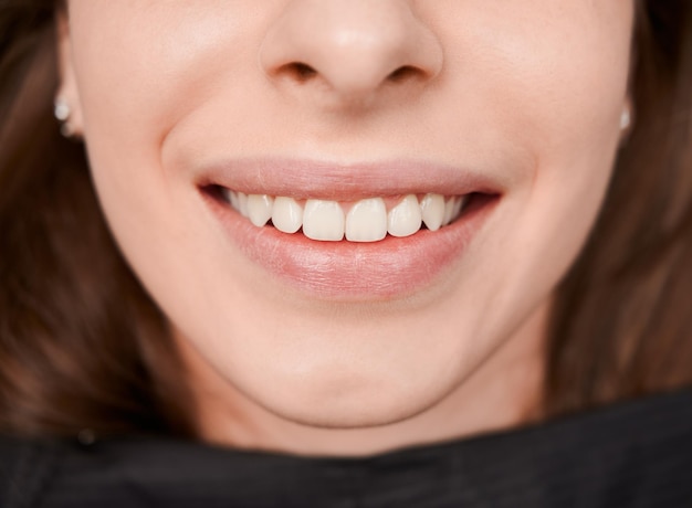 Fotografia macro de um belo sorriso feminino com dentes brancos e saudáveis