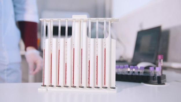 Frascos com diferentes amostras de sangue em laboratório médico