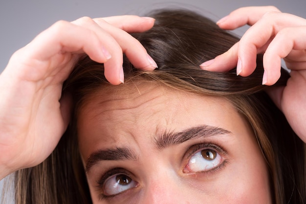 Frau mit Haarausfallproblem. Porträt des jungen Mädchens mit einer Glatze. Kopfschuss eines nervösen Mädchens mit einer Haarbürste.