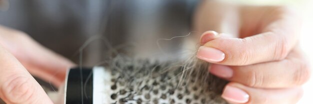 Frau schaut auf ihre gefallenen Haare auf Haarbürste Kamm mit Haaren in weiblichen Händen Nahaufnahme Symbol von