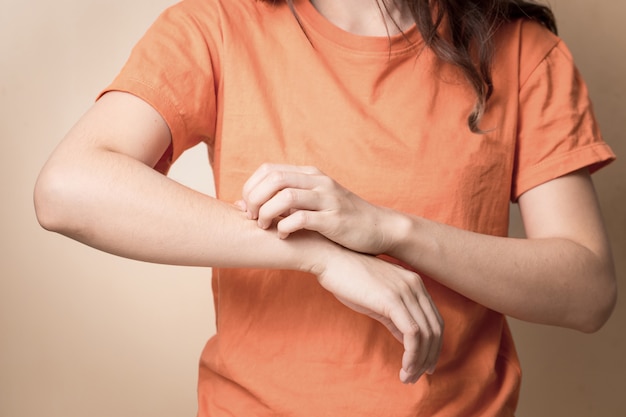 Frauen kratzen juckenden Arm mit der Hand.