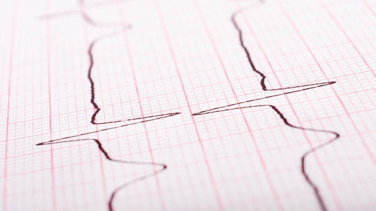 Foto frecuencia cardíaca en primer plano de cardiograma de papel.