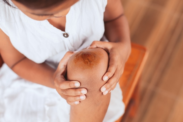 Frische Wunde und Blut von verletzten Kindern am Knie nach einem Unfall