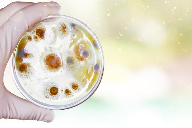 Für Bakterien charakteristische Kolonien zur Untersuchung in der Labormikrobiologie.