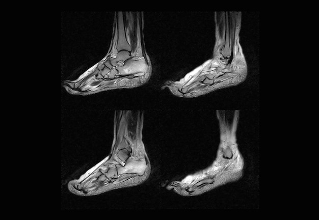 Fuß-MRT und CT-Röntgenbild