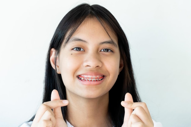 Garota de aparelho dental sorrindo e olhando para a câmera no fundo branco, ela se sente feliz e tem uma boa atitude com o dentista. Motive as crianças sem medo quando tiverem que ir à clínica odontológica.