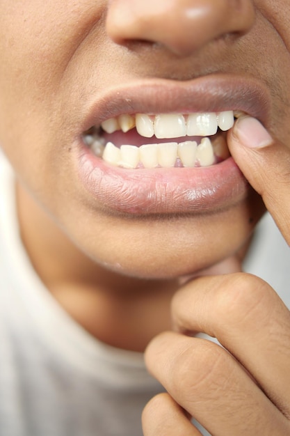 Garoto adolescente com dentes sensíveis
