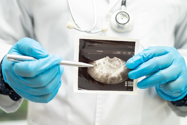 Gebärmutter- und Eierstockarzt hält Anatomiemodell und Ultraschallbild für Studiendiagnose und Behandlung im Krankenhaus