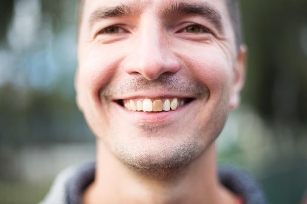 Gelber beschädigter Zahn eines lächelnden kaukasischen Mannes in Nahaufnahme konzentriert sich auf die Zähne Zahnprobleme