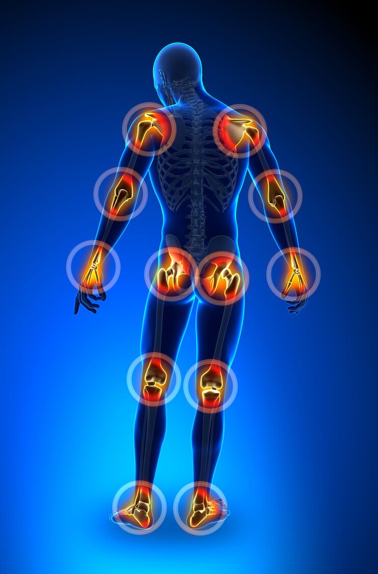 Gelenkschmerzen Vollfigur Arthritis Anatomie-Konzept