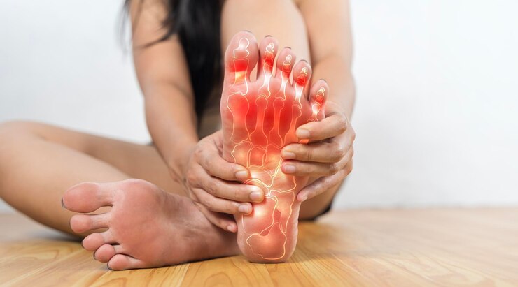 Gota dolorosa e inflamada no pé Uma mulher com pés vermelhos está sentada no chão
