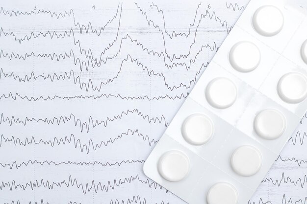 Gráfico de eclectroencefalograma em close-up no diagnóstico de epilepsia em papel