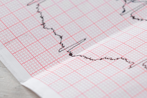 Gráfico de eletrocardiograma do coração ekg em papel especial. conceito de tomografia cardíaca, seguro saúde, antecedentes médicos, exames.