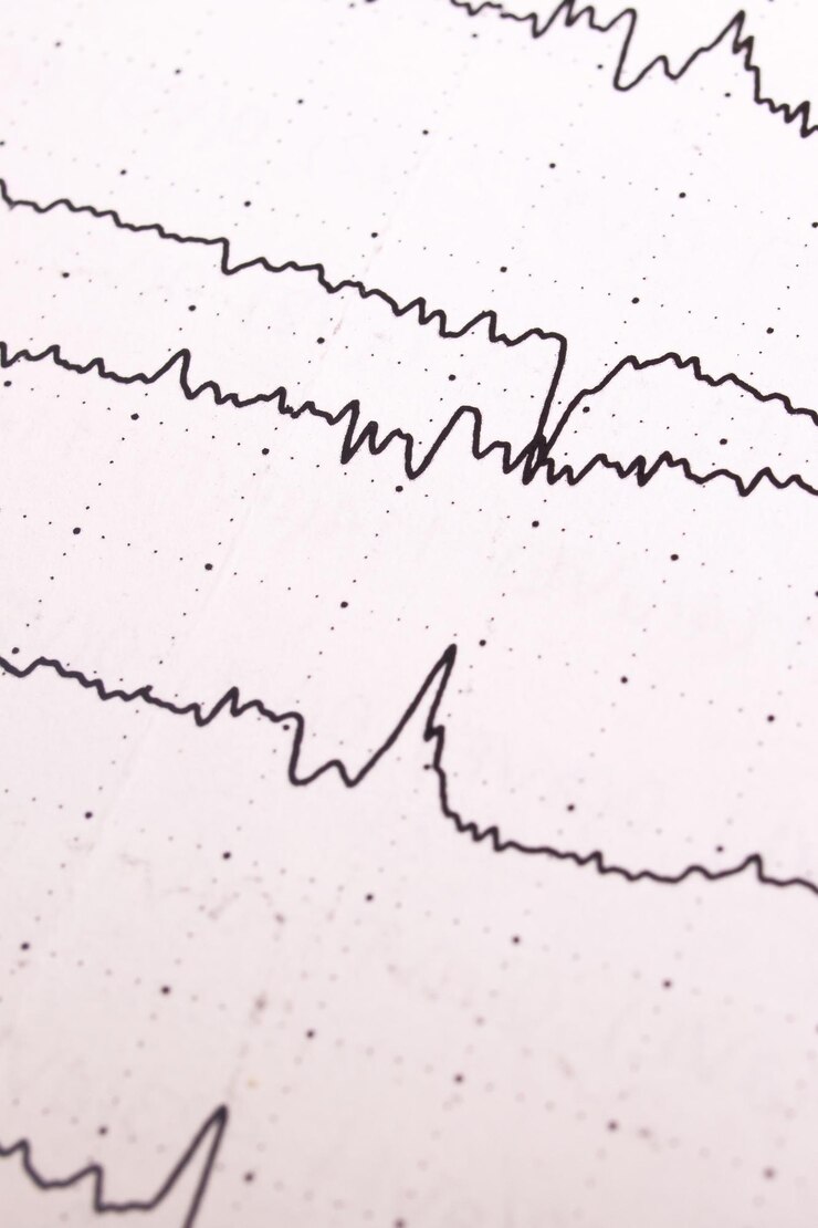 Gráfico de eletroencefalograma em papel branco close-up