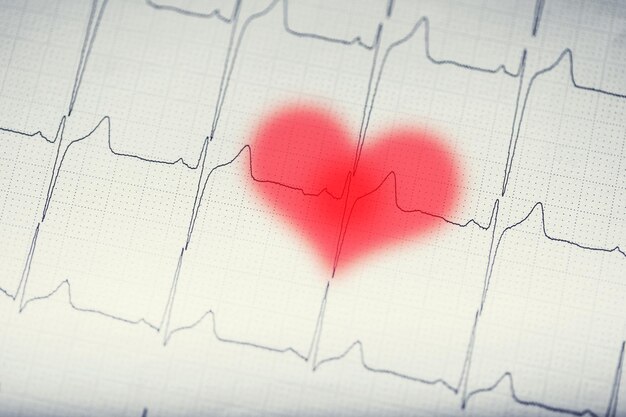 Foto gráfico de ecg electrocardiograma de ecg con corazón borroso en rojo