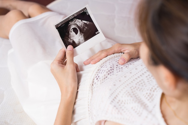 Foto grávida, mulher asian, olhar, ultrasonografia, varredura, de, bebê, e, tocar, dela, barriga