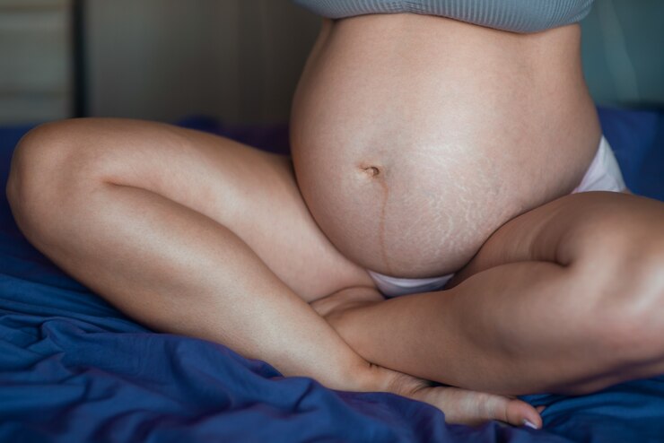 Gravidez de foto de alta resolução. O estômago da mulher grávida é um close-up. Coração com as mãos na barriga. Uma mulher acaricia seu estômago. Textura natural da pele. Pele danificada com estiramentos, cicatrizes, listras
