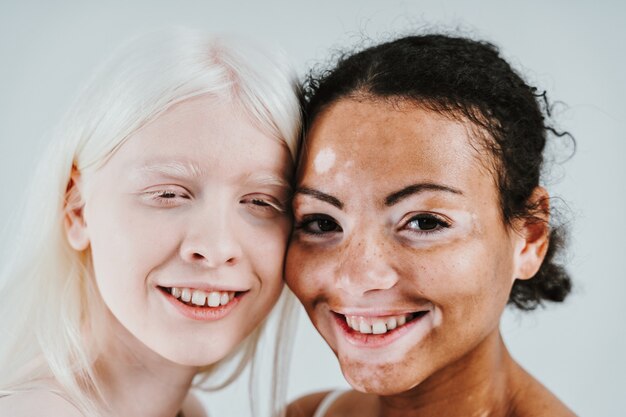 Grupo de mulheres multiétnicas com diferentes tipos de pele posando juntas em estúdio