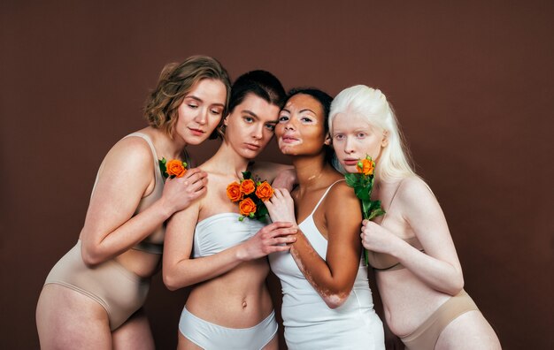 Grupo de mujeres multiétnicas con diferentes tipos de piel posando juntas en estudio. Concepto de positividad corporal y autoaceptación