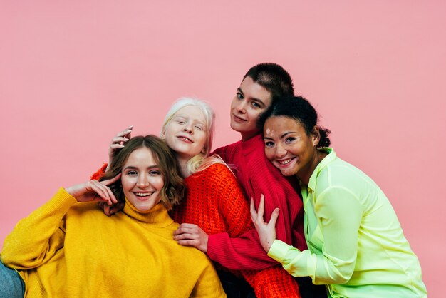 Grupo de mujeres multiétnicas con diferentes tipos de piel posando juntas en el estudio