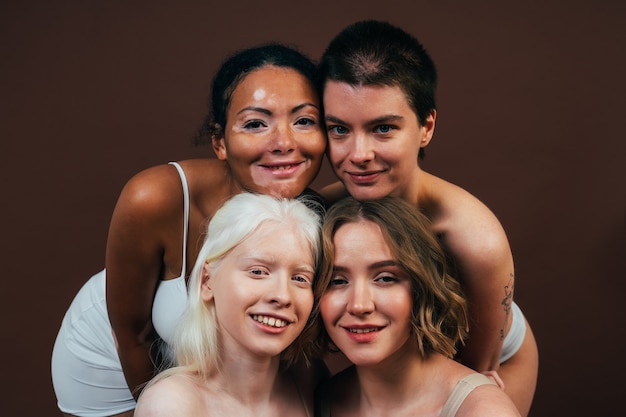 Grupo de mujeres multiétnicas con diferentes tipos de piel posando juntas en el estudio