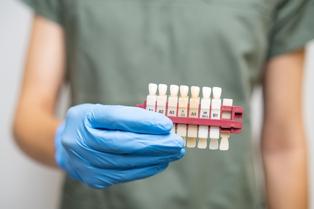 Foto guía de sombra de dientes para blanquear en los dentistas mano en guantes de goma