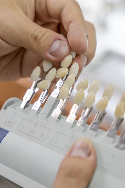 Guías organizadas de tonos dentales con etiquetas alfanuméricas que muestran varios colores de dientes