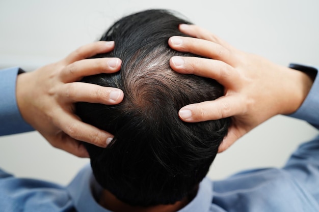 Haarausfall bei Männern Behandlung von gesundheitlichen Problemen