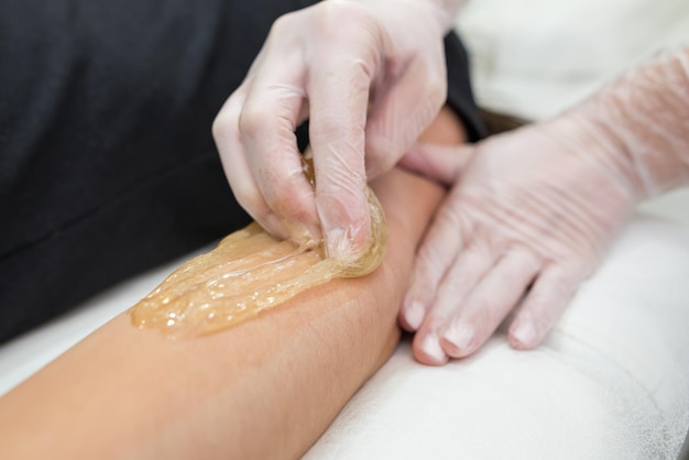 Haarentfernungsverfahren mit Zuckerpaste Shugaring Kosmetikerin trägt Zuckerpaste auf die Hand einer jungen Frau aufEnthaarung weiblicher Hände in einem Schönheitssalon