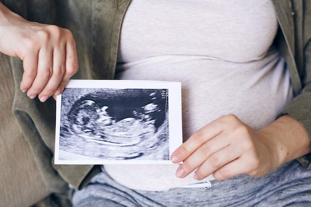 Hände der schwangeren Frau ich Freizeitkleidung, die Foto ihres zukünftigen Babys über schwangerem Bauch beim Sitzen hält