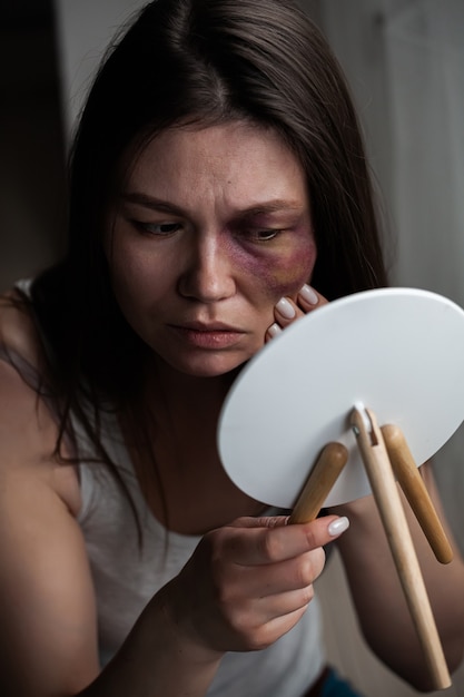 Häusliche Gewalt, Missbrauch Frau mit Prellung im Gesicht am Fenster schaut in den Spiegel