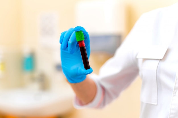 Hand des labortechnikers mit schützendem blauem handschuh hält phiole mit blut. blutprobe im reagenzglas in der hand des weiblichen laborassistenten. nahansicht.