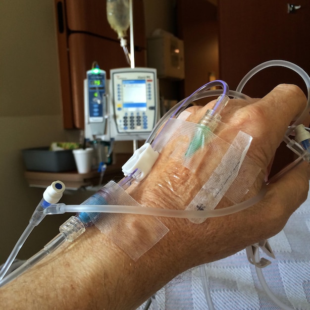 Foto hand des patienten mit intravenöser transplantation