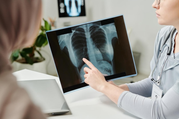 Hand eines jungen Arztes, der während der Konsultation auf ein Röntgenbild der Lunge zeigt