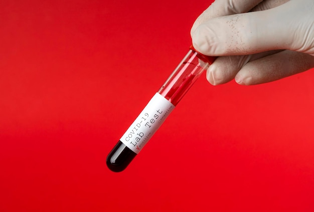 Foto hand holds a test tube containing a test sample