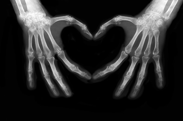 Handknochen als Zeichen der Liebe