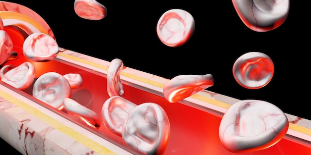 Hautschicht rote Blutkörperchen Venengefäßchirurgie 3D-Darstellung