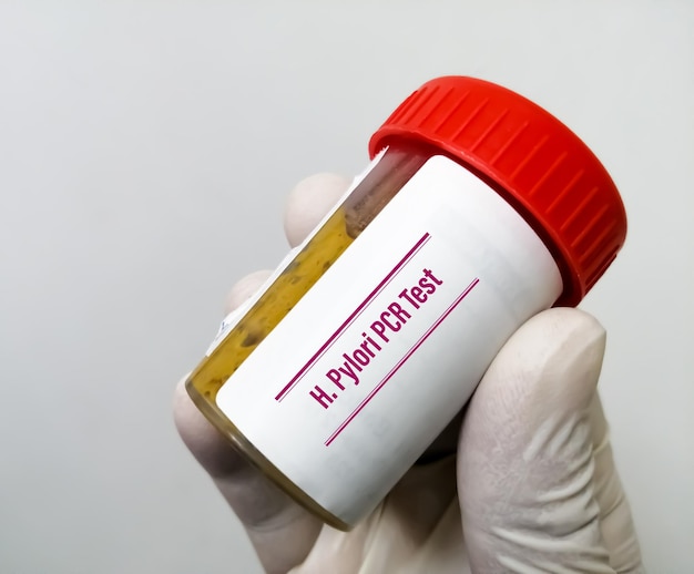 Helicobacter-pylori- oder Helicobacter-pylori-PCR-Test