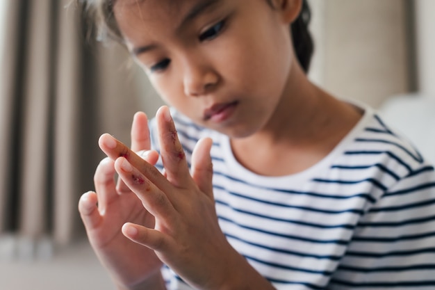 Herida fresca y sangre de heridas en los dedos de un niño después de un accidente.