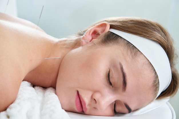 Hermosa mujer descansando en una cama con tratamiento de acupuntura con agujas dentro y alrededor de la oreja