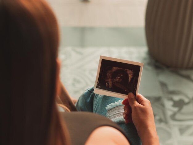 Foto hermosa mujer embarazada viendo el eco de su bebé