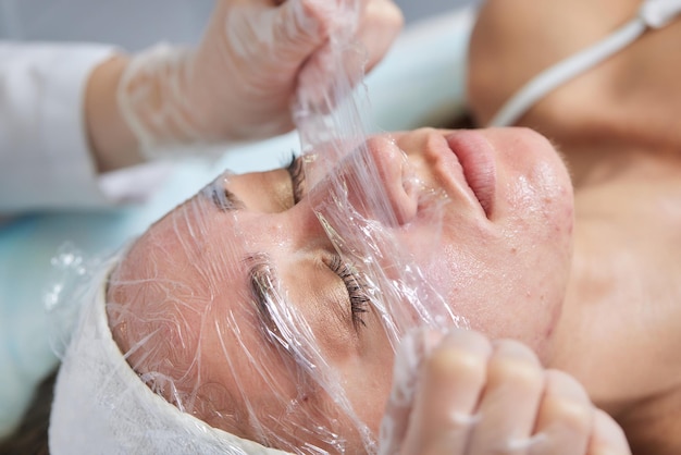 Hermosa mujer en el salón de spa Tratamiento de hiperpigmentación y melasma en la cara con máscara de suero Procedimiento de rejuvenecimiento facial